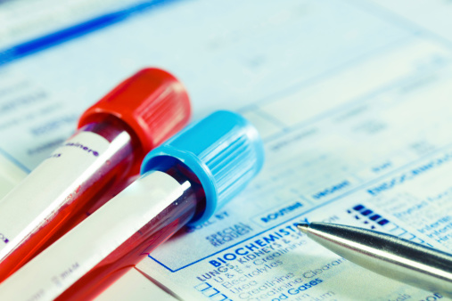 Insights on Testosterone Testing
